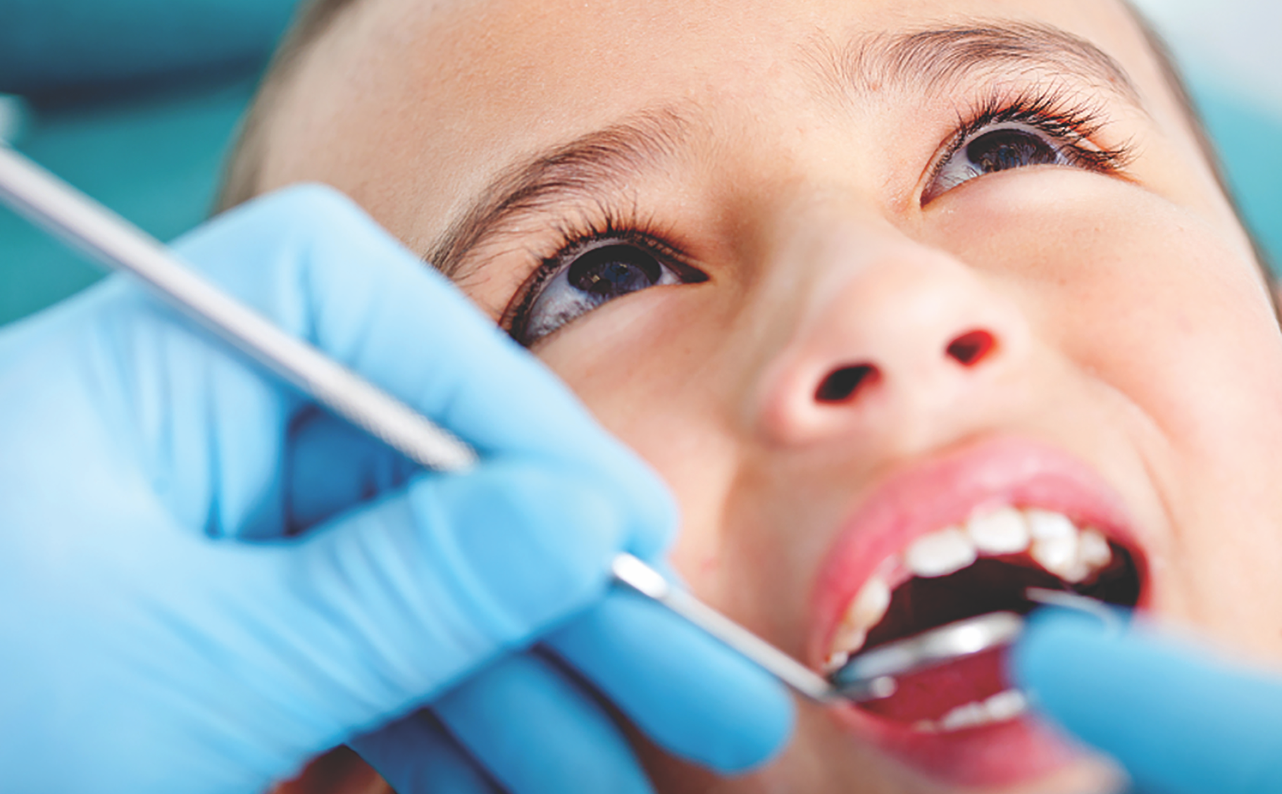 easy-prevention-of-child-tooth-decay