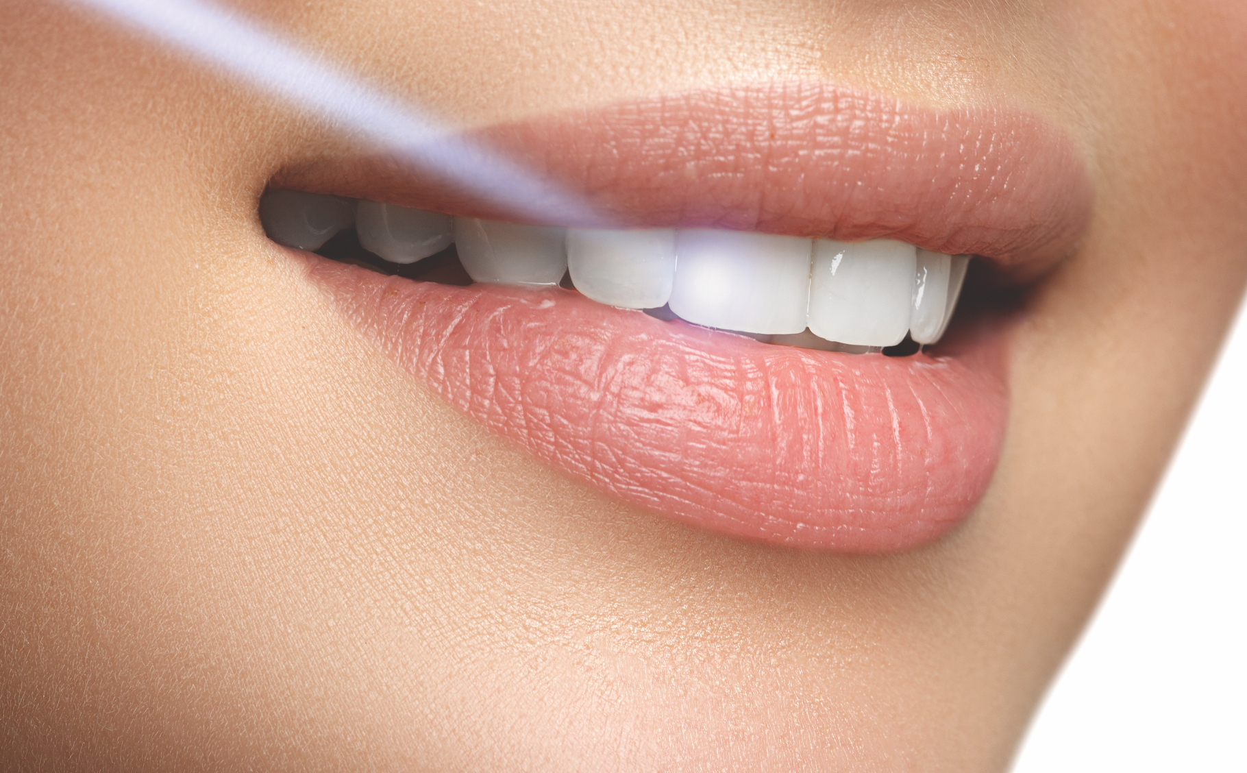laser-dentistry